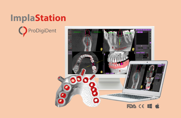 ImplaStation